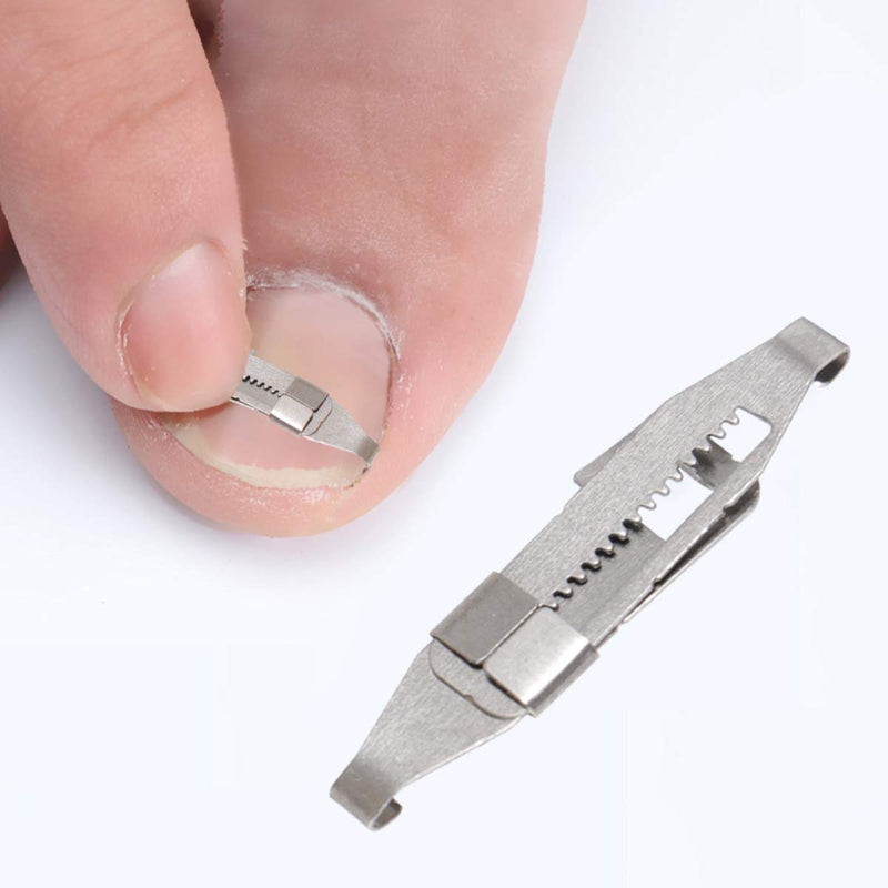 Exceart Toenails Correction Stainless Steel Clip Buckle Ingrown Toenail Tool for Men Women 1pc - BeesActive Australia
