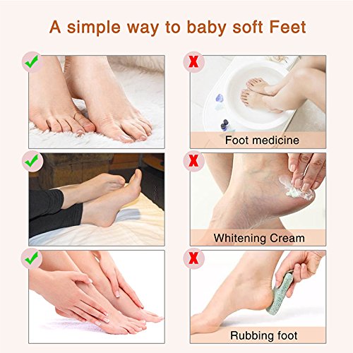 Foot Peel Mask - 3 Pack - Deep Exfoliating Peel Off Mask for Women and Men For Cracked Heels, Dead Skin and Calluses - Make Your Feet Baby Soft Get Smooth Silky Skin - Removes Rough Heels Dry Skin Lavender - BeesActive Australia
