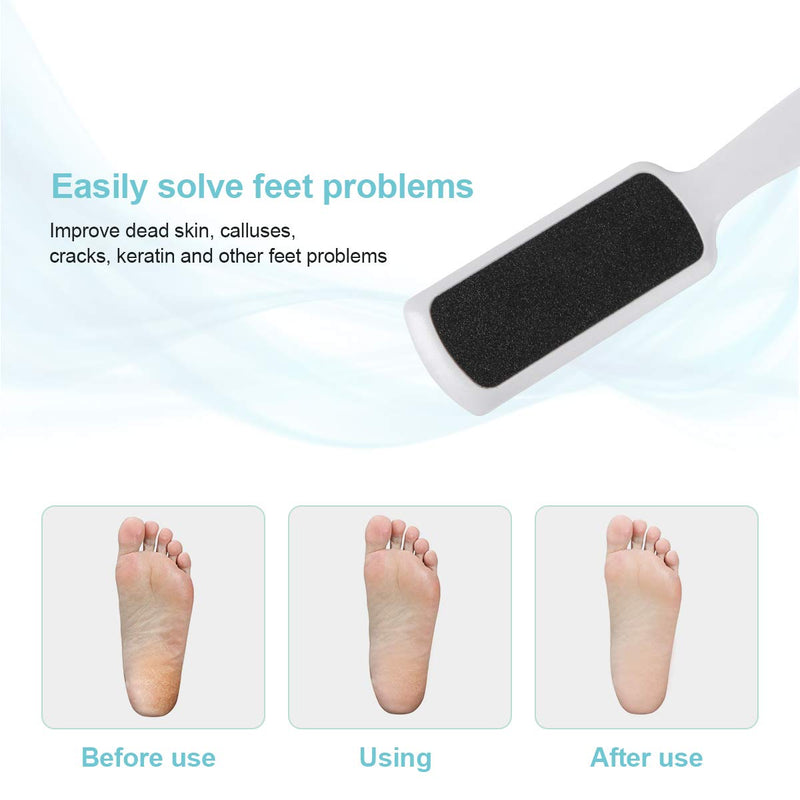 Yeipis Pedicure Foot Rasp File Callus Remover, Double-Sided Colossal Foot Rasp Foot File And Callus Remover For Dead Skin (Pack of 3) - BeesActive Australia