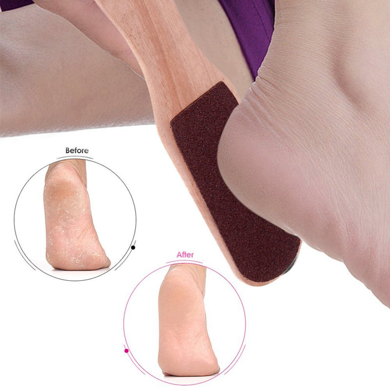 Anself Double Sided Foot Rasp Manicure File Callus Remover Pedicure Tool 1 Count (Pack of 1) - BeesActive Australia