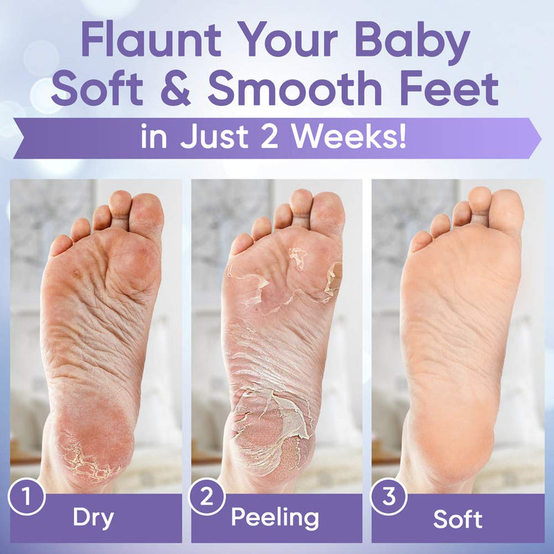 Foot Peel Mask - Foot Mask 2 Pack for Baby Feet and Remove Dead Skin - Baby Foot Peel Mask with Lavender and Aloe Vera Gel for Men and Women Feet Peeling Mask - BeesActive Australia