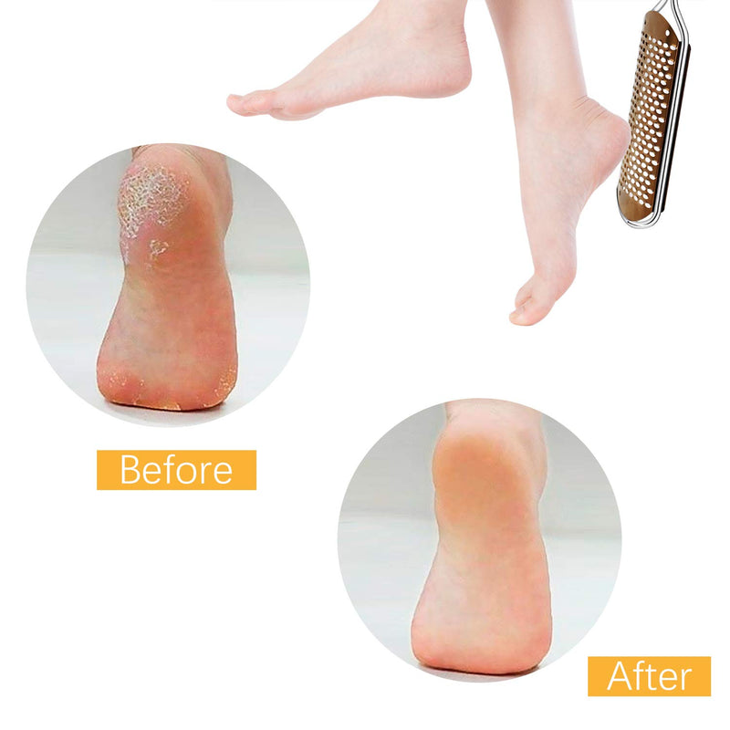 Pedicure Foot File Callus Remover - Large Foot Rasp Colossal Foot Scrubber Professional Stainless Steel Callus File for Wet and Dry Feet (Athens Copper) Athens Copper - BeesActive Australia