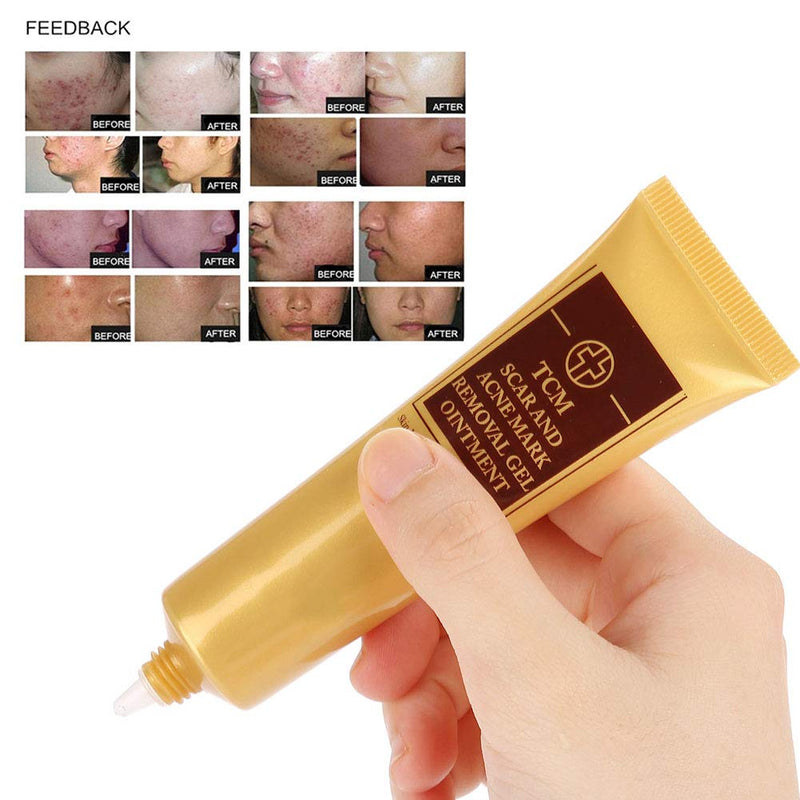 Acne Scar Removal Cream, Removal Ointment Gel Scar Marks Repair Skin Scre Natural Scar Repair Cream Acne Treatment Skin Brightening Lotion for Face and Body - BeesActive Australia