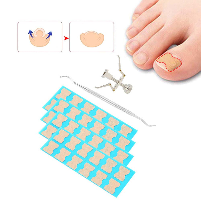 Mild Painless Toenail Correction Patch, Pedicure Ingrown Nail Corrector, Professional for Men Women Ingrown Nail Toenail Care Tool(48 pieces) 48 pieces - BeesActive Australia