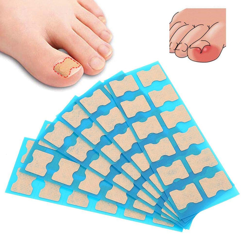 Ingrown Toenail Sticker, Ingrown Toenail Correction Patch Ingrown Toenail Tools Professional Foot Care Tool (70 pcs) 70 Pcs - BeesActive Australia