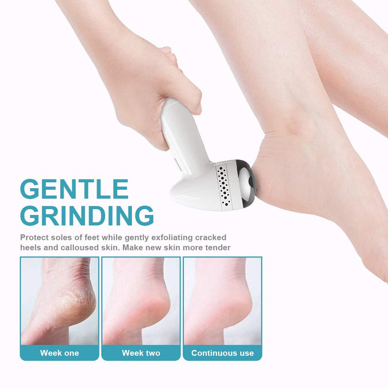 Electric Feet Callus Remover,USB Portable Electric Vacuum Adsorption Foot Grinder, Foot File Pedicure Foot Care Tools, Dual-Speed Callus Remover for Dead Hard Cracked Dry Skin, Foot Heel Repair - BeesActive Australia