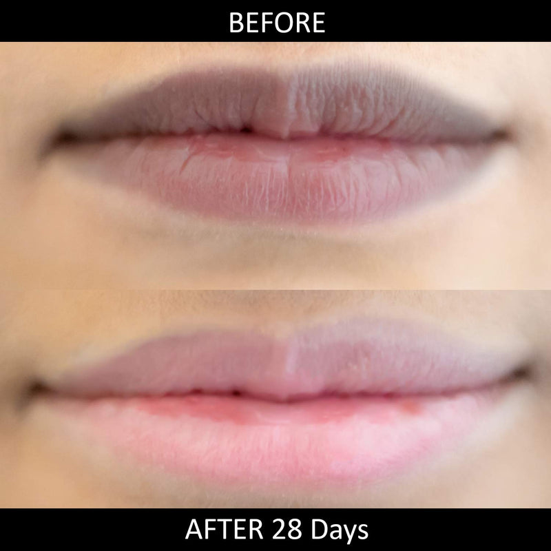Omorfee 100% Organic Lip Lightening Stick for Dark Lips, Lip Whitening Lipstick with SPF, Natural Lip Balm Protection & Repair, Cocoa Butter, Carrot Seed Oil & Pineapple Extract - 6 Grams/0.21 Oz - BeesActive Australia