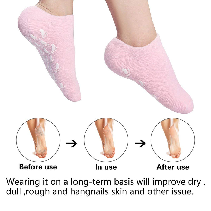 Moisturizing Gel Socks, Ultra-Soft Gel Socks Moisturizing Socks, Spa Gel Soften Socks for Dry Cracked Feet Skins, Gel Lining Infused with Oils and Vitamins (2 Pair Blue&Pink) Blue & Pink - BeesActive Australia