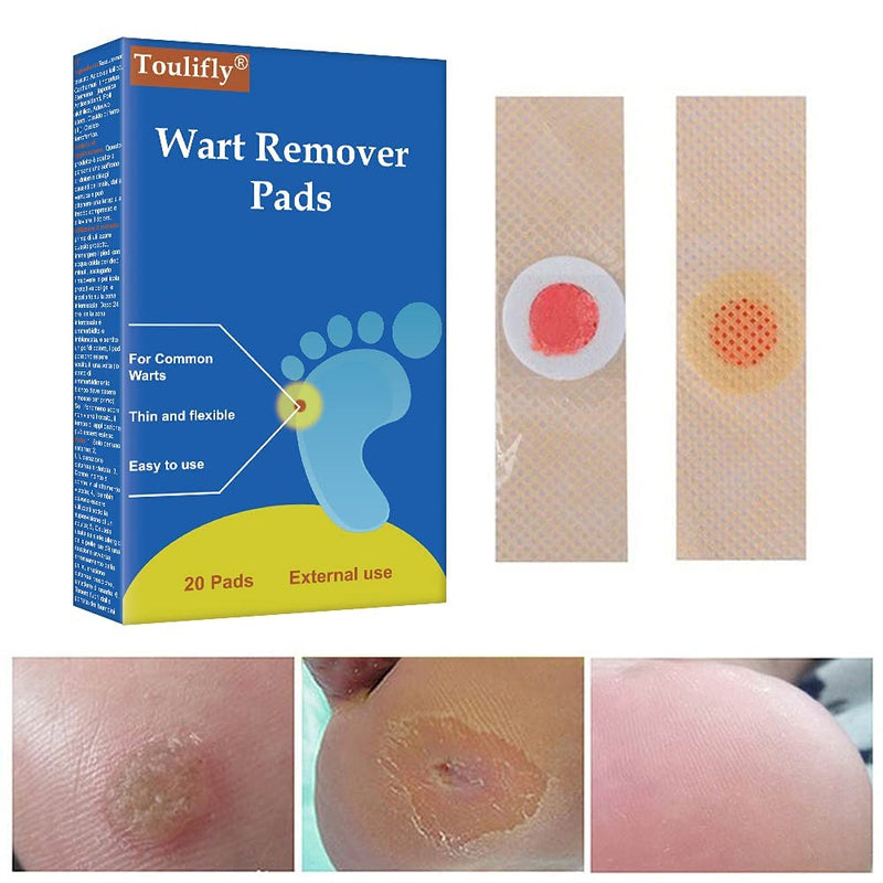 Wart Remover, Wart Remover Pads, Wart Treatment, Wart Remover for Hands, Feet, Feet Callus Remove, Verruca and Wart, Relief Pain Removal Warts Plaster, Soften Skin Cutting Sticker Toe Protector, 20 PC - BeesActive Australia