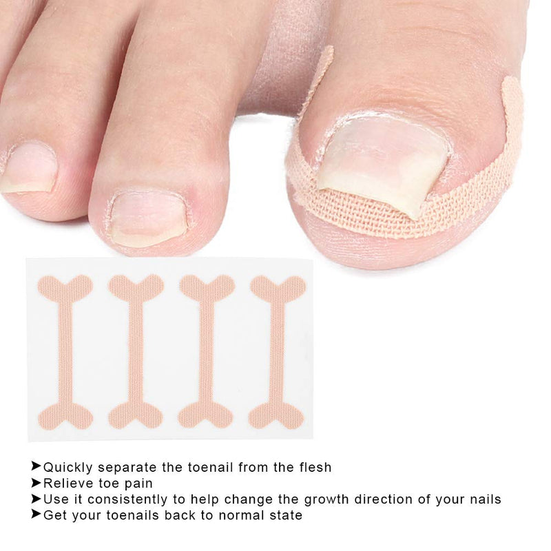 Ingrown Nail Correction Bandage Pain Relief Paronychia Treatment Band Sticker 24pcs - BeesActive Australia