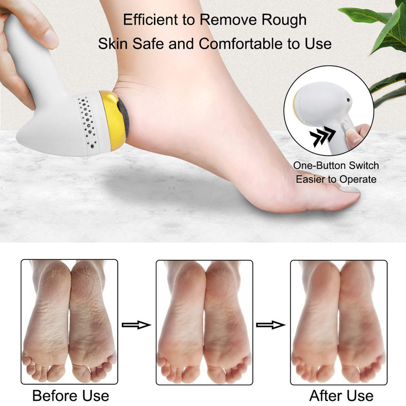 CGBE Electric Callus Remover For Feet, Electronic Vacuum Foot File, Portable Rechargeable Dead Skin Remover for Feet,Pedicure Tool Kit Foot Care for Dead Hard Cracked, Feet Scraper Ideal Gift Upgrade Gold - BeesActive Australia