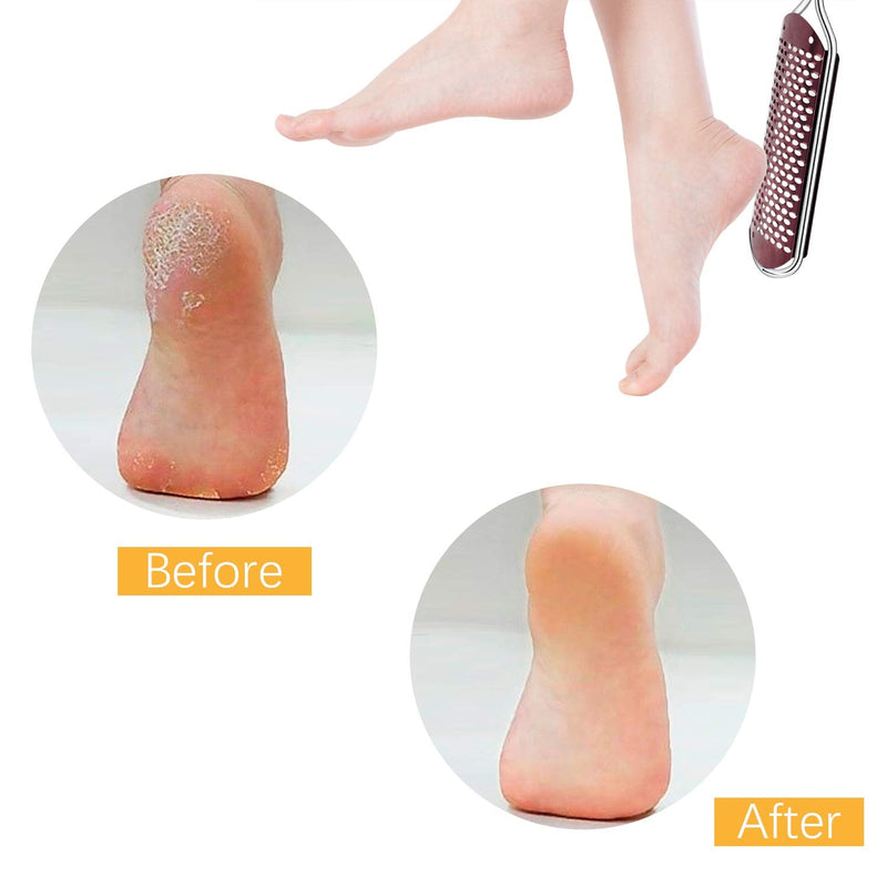 Pedicure Foot File Callus Remover - Large Foot Rasp Colossal Foot Scrubber Professional Stainless Steel Callus File for Wet and Dry Feet - BeesActive Australia