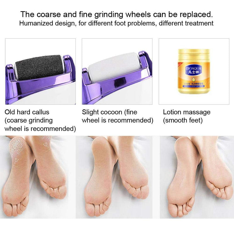 Professional Electric Callus Remover, USB Charging Foot File for Dead Skin Removal Exfoliating, Pedicure Foot Care Foot Rasp Tool - BeesActive Australia