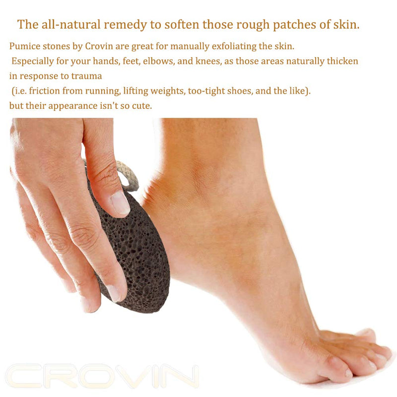 CROVIN Foot Pumice Stone for Feet Callus Remover - Natural Earth Lava Foot Scrubber Pack of 2 - Hypoallergenic Foot Peel in Foot Spa Quality - Pedicure Foot File - BeesActive Australia