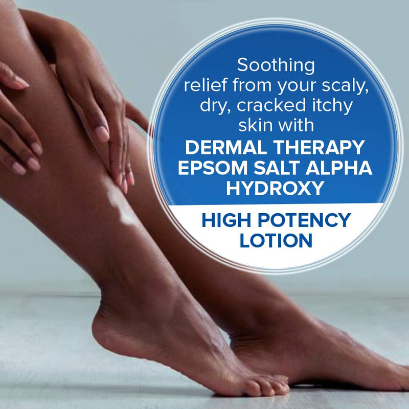 Dermal Therapy Epsom Salt Alpha Hydroxy High Potency Lotion – Moisturizing, Exfoliating and Soothing Treatment for Scaly, Flaky, Dry Skin | Epsom Salt, 10% Urea and 10% Lactic Acid | 16 fl.oz - BeesActive Australia