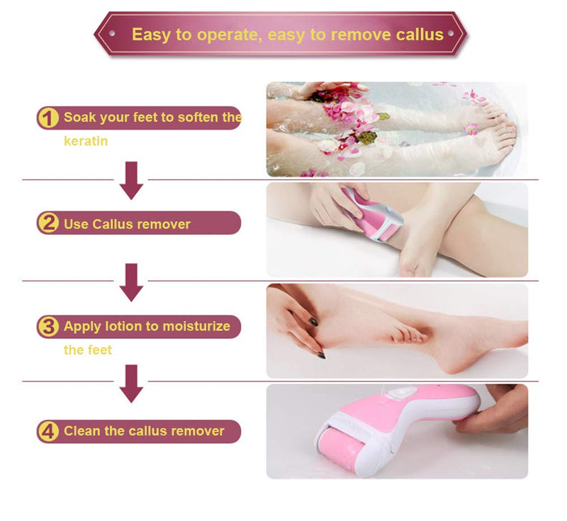 Electric Callus Remover for Feet: Rechargeable Electric Foot File, Foot Scrubber for Dead Skin, Professional Feet Care for Cracked Heels (Pink) Pink - BeesActive Australia