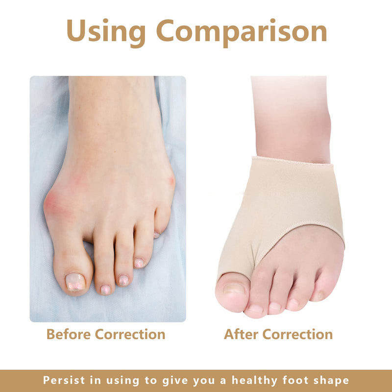 2 Pcs Toe Pad, Orthopedic Bunion Splint, Plantar Corrector, Fasciitis Relief Cushion, Orthopedic Bunion Protector with Silicone Painful Pad- Stop Pigeon-toed Pain Toe Tube for Men and Women(Apricot-S) - BeesActive Australia