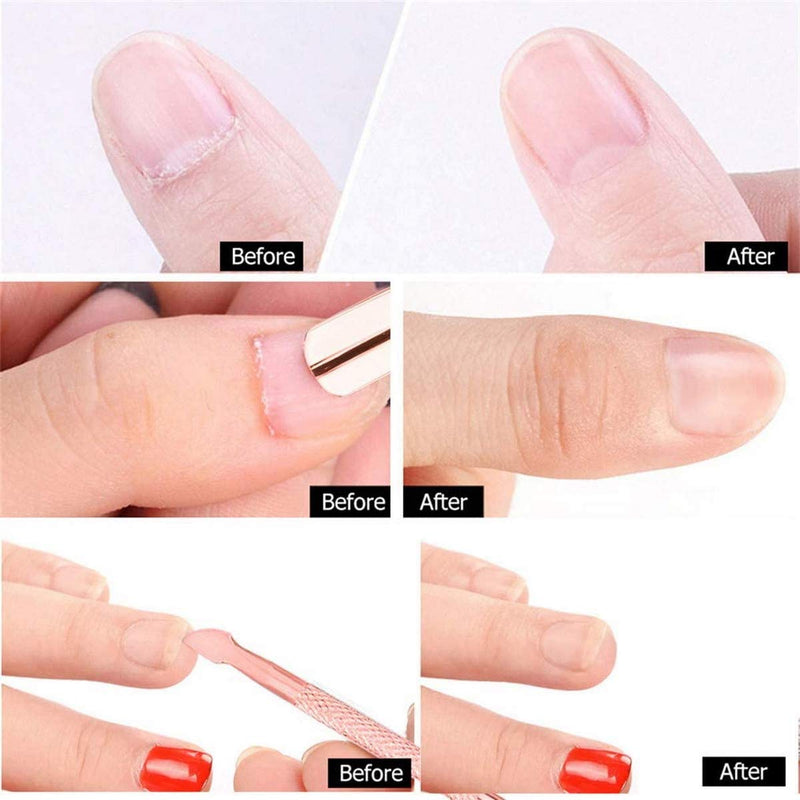 Cuticle Peeler Scraper Remove Gel Nail Polish and Cuticle Pusher and Spoon Nail Cleaner, Durable Pedicure Manicure Tools for Fingernails Toenails - BeesActive Australia