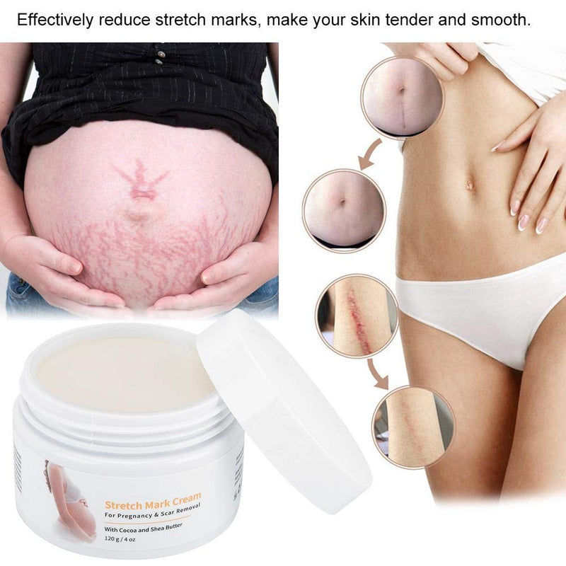 Stretch Mark Cream, Postpartum Obesity Cream, Remove Stretch Marks, Repair Scar Slack Line Abdomen Stretch Marks Postpartum 120g - BeesActive Australia