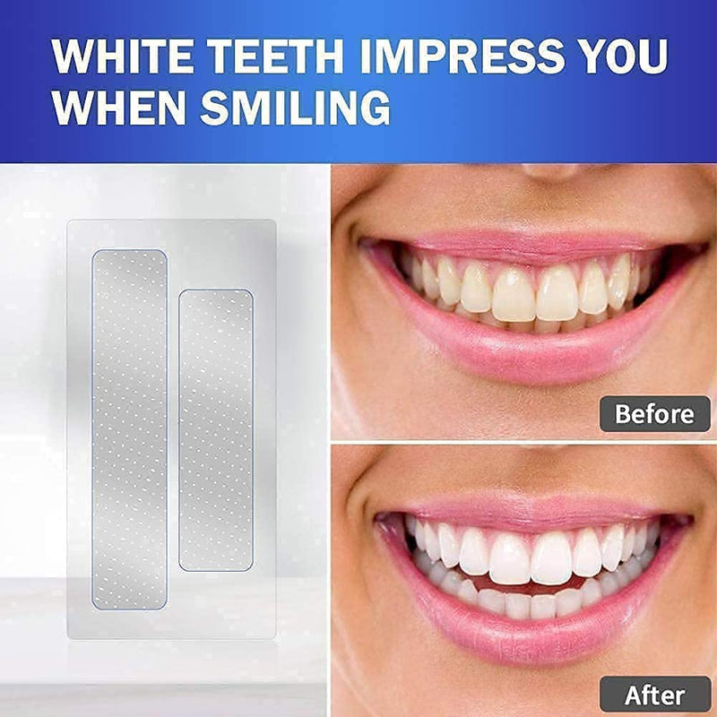 Teeth Whitening Strips,Teeth Bleaching,Whiten Teeth with Fast Results,Premium Quality Teeth Bleaching Kit for White Teeth and Fresh Breath（7pack). - BeesActive Australia