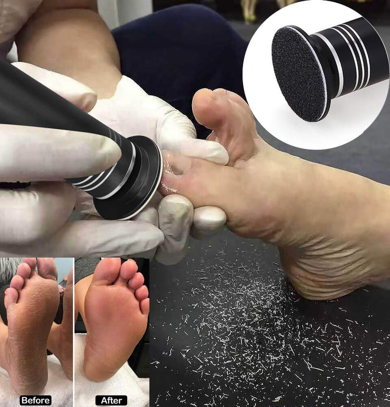 Electric Foot Callus Remover Adjustable Speed Electronic Hard Skin Remover Machine with 60pcs Replaceable Sandpaper Discs (Black) Black - BeesActive Australia