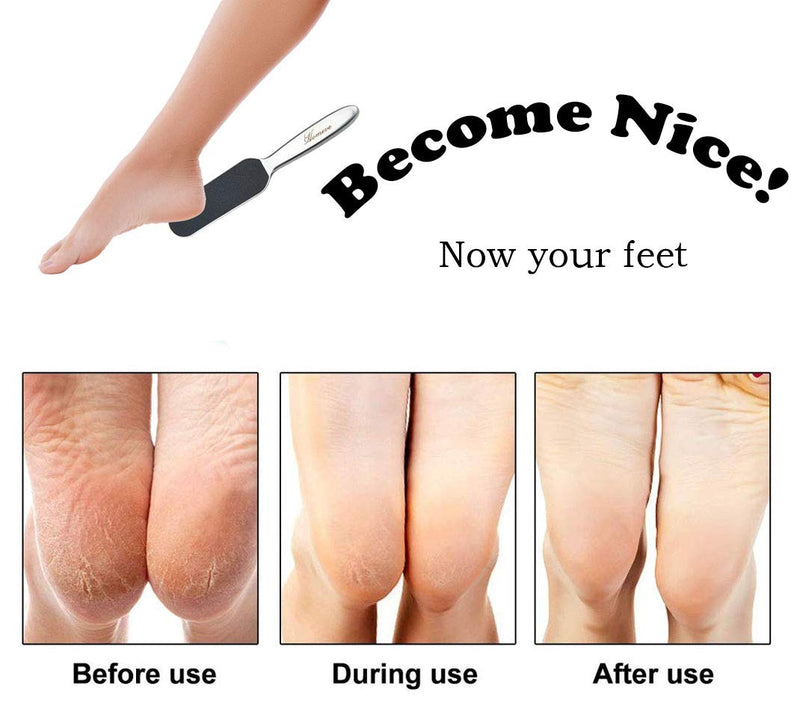 Professional Pedicure Foot File - Reusable Stainless Steel Cracked Skin Corns Callus Remover Feet Rasp - BeesActive Australia