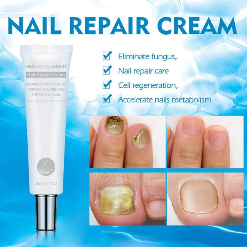 MISEDI 2 Pack Natural Nail Care Repair Cream Moisturizing Nail Treatment Onychomycosis Soften The Cuticle, Vibrant Glamour Nail Repair Cream - BeesActive Australia