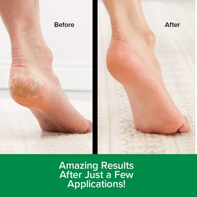 Hempvana Heel Tastic Foot Cream for Dry Cracked Feet - Cracked Heel Treatment Enriched with Hemp Seed Oil - Foot Lotion Promotes Healthy Feet for Women + Men - BeesActive Australia