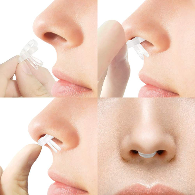 WoodyKnows Super-Support Nasal Dilators (Small 3 Pack) S (Pack of 3) - BeesActive Australia