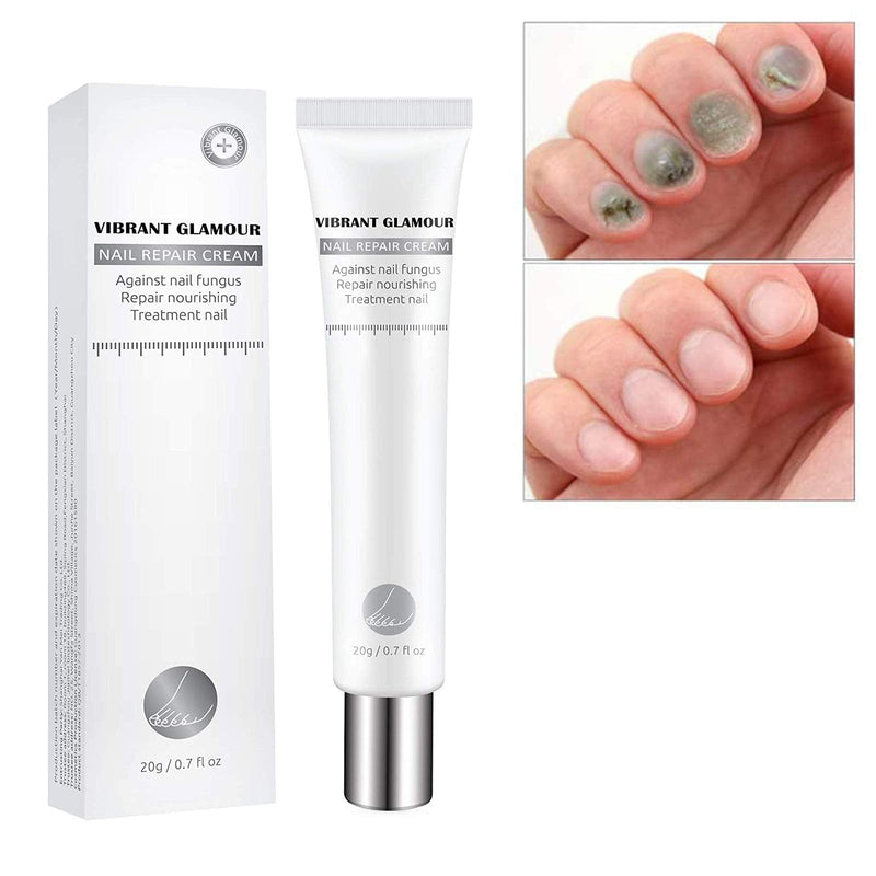 MISEDI 2 Pack Natural Nail Care Repair Cream Moisturizing Nail Treatment Onychomycosis Soften The Cuticle, Vibrant Glamour Nail Repair Cream - BeesActive Australia