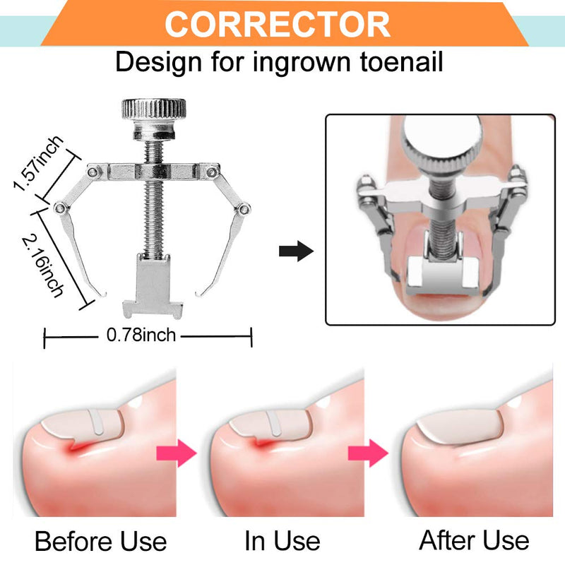 Kimihome Ingrown Toenail Treatment(7PCS), Professional Toenail Clippers, Ingrown Toenail Treatment Pedicure for Ingrown & Thick Nail, Stainless Steel Ingrown Toenail Tools - BeesActive Australia