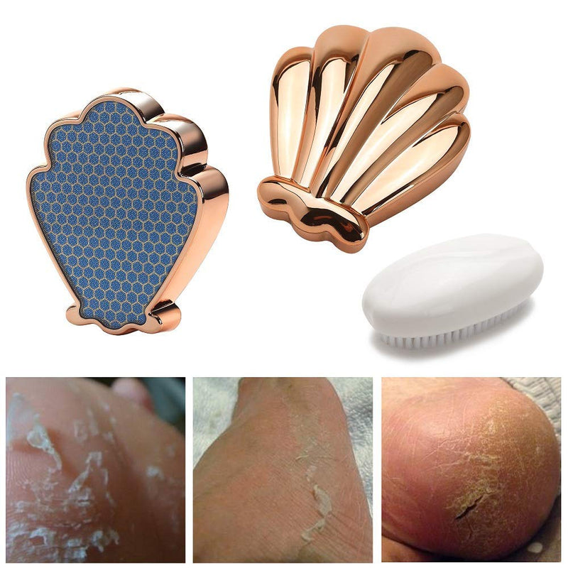 Colossal Foot Rasp Foot File and Callus Remover, Nano Glass Material, Can Be Used On Both Dry and Wet Feet, on Trimming Dead Skin, Callus, Foot Corn, Cracked Heels - BeesActive Australia