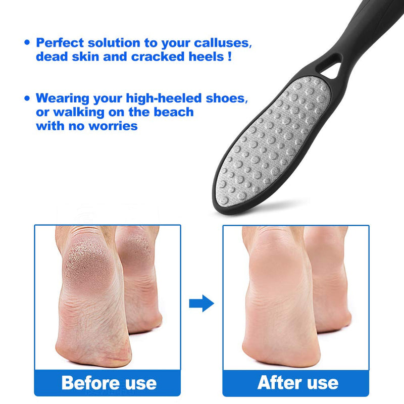 Pedicure Foot File Callus Remover, Double-Sided Colossal Pedicure Foot RASP, Dead Skin Exfoliator for Feet - BeesActive Australia