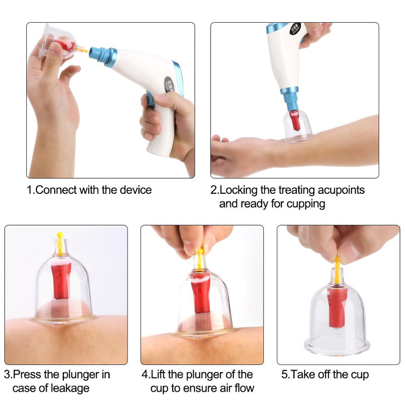 Vacuum Suction Cupping Kit, Cupping Therapy Set, Electric Vacuum Suction Cupping Kit Lymph Drainage Pain Relief Massage Cupping Set Health Care - BeesActive Australia