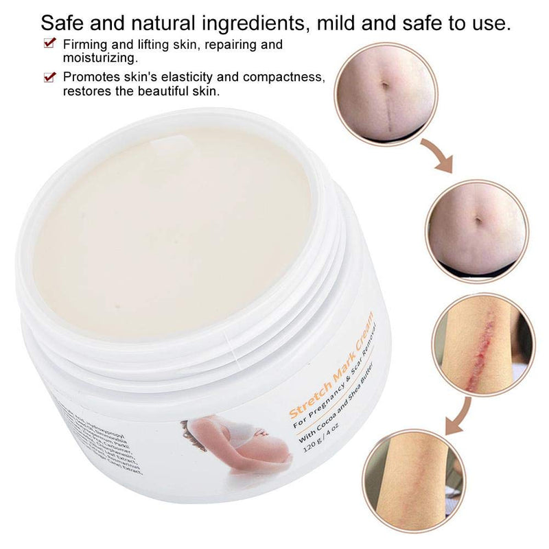 Stretch Mark Cream, Postpartum Obesity Cream, Remove Stretch Marks, Repair Scar Slack Line Abdomen Stretch Marks Postpartum 120g - BeesActive Australia