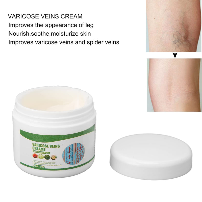 30g Varicose Veins Leg Cream, Varicose Veins Cream Pain Relief Soothing Leg Massage Cream for Spider Veins Treatment - BeesActive Australia