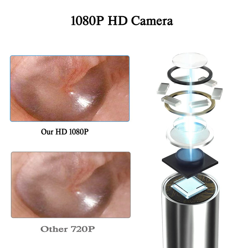 Ear Wax Remover TODEHI 1080P FHD Wireless Ear Wax Removal Kit WiFi Ear Cleaner Camera with 6 LED Lights, Visual Ear Otoscope for Adults, Kids & Pets - BeesActive Australia