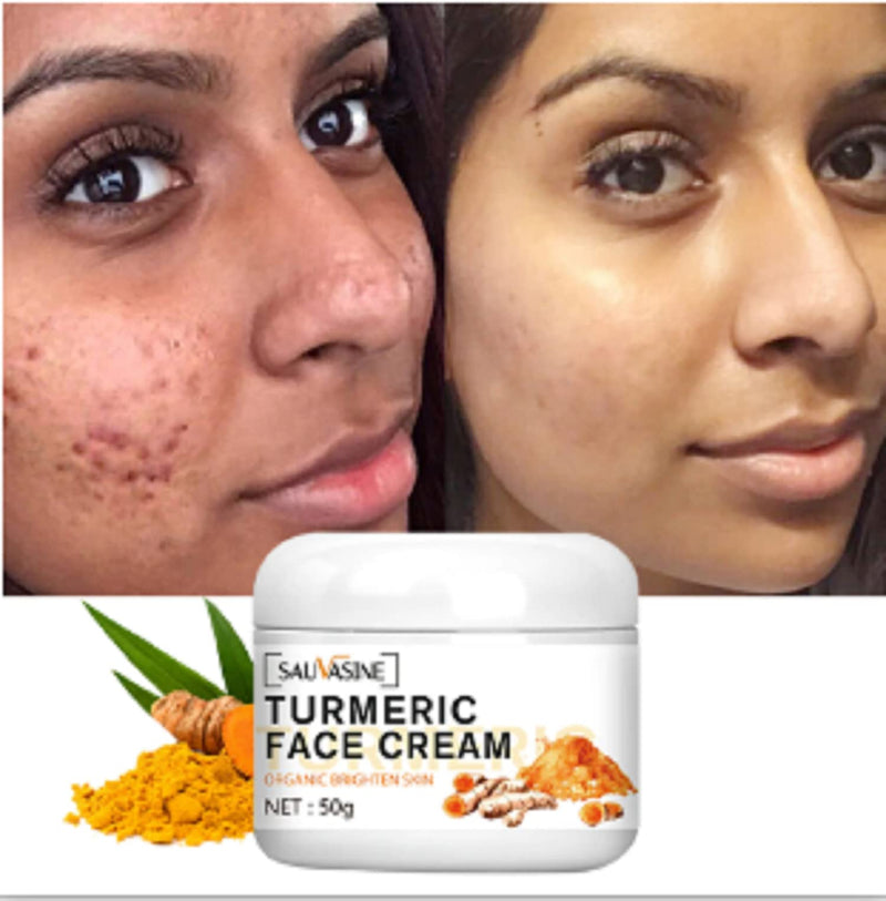 Lanthome Turmeric Face Cream for Face (50g)-Skin Care Anti-Aging Cream Face Moisturizer Cream,Skin Moisturizing Repair Cream, Turmeric Moisturizer Cream for Dark Spots - BeesActive Australia