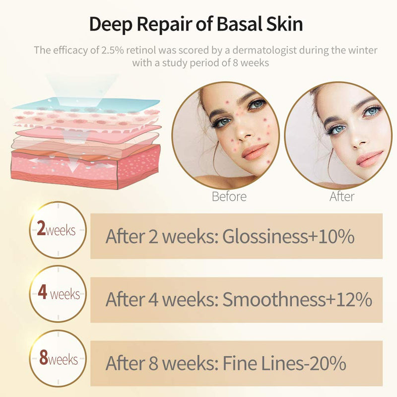 Retinol Serum,ETRONG High Strength Anti-aging Serum with 2.5% Retinol,Hyaluronic Acid and Vitamin E for Face Acne (30ml) 30 ml (Pack of 1) - BeesActive Australia