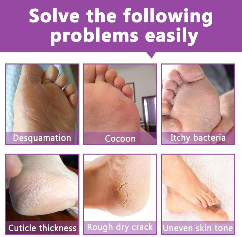 Exfoliating Foot Peel Mask For Peeling Away Cracked Heels, Dead Skin & Calluses Removes Repair Rough Heels, Get Silky Soft Feet Pack of 2 Pair - BeesActive Australia