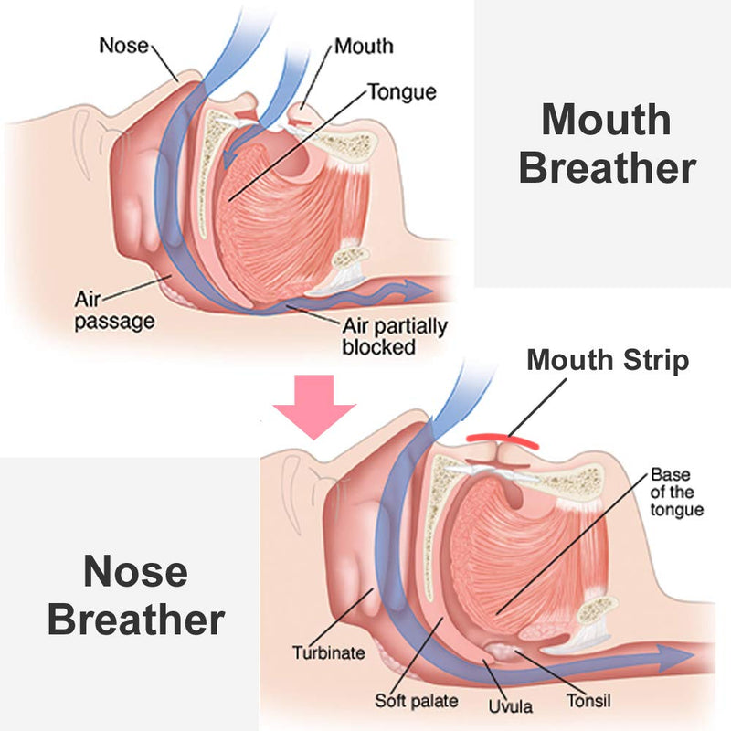 WoodyKnows Mouth Tape, Anti Snoring Mouth Strips for deep Sleep, Develop The Habit of Nasal Breathing, Maintain Natural Face Shape (Extra Strength, Newly Launched, 24 Pieces) Extra Strength (Newly Launched) 24 Pieces - BeesActive Australia