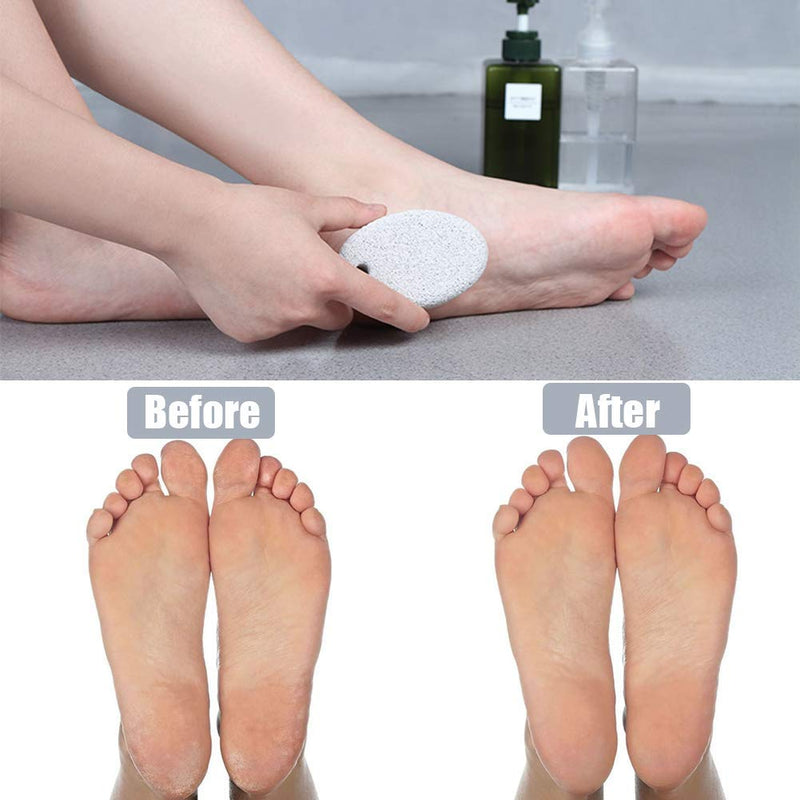 Pumice Stone 2 Pcs, Natural Lave Pumice Stone for Feet/Hand, Small Callus Remover/Foot Scrubber Stone for Men/Women by MAYKI White - BeesActive Australia