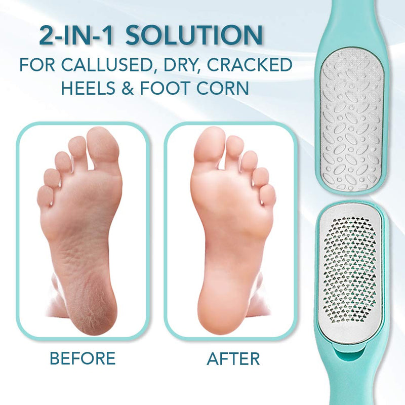 Callus Remover For Feet | Double-sided Dead Skin Remover - Rough Pedicure Foot File For Exfoliation & Fine Foot Scrubber for Smoothing & Softening Skin - BeesActive Australia