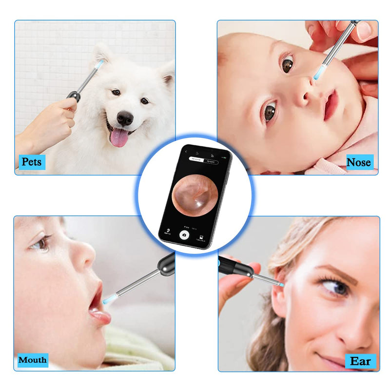 Ear Wax Remover TODEHI 1080P FHD Wireless Ear Wax Removal Kit WiFi Ear Cleaner Camera with 6 LED Lights, Visual Ear Otoscope for Adults, Kids & Pets - BeesActive Australia
