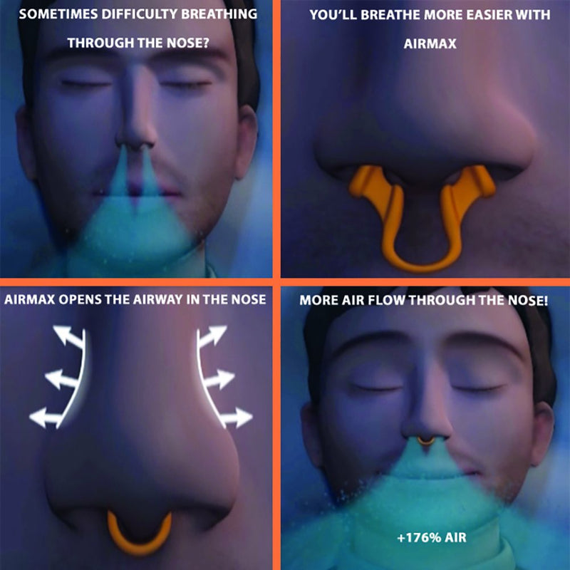 Airmax nasal dilator trial pack | anti snore devices | 76% more air | Breathe freely through the nose | Guaranteed fit 1x small & 1x medium | Snoring aid for men and women | sleep better and wake up rested | nasal congestion | Free storage case incl. - BeesActive Australia