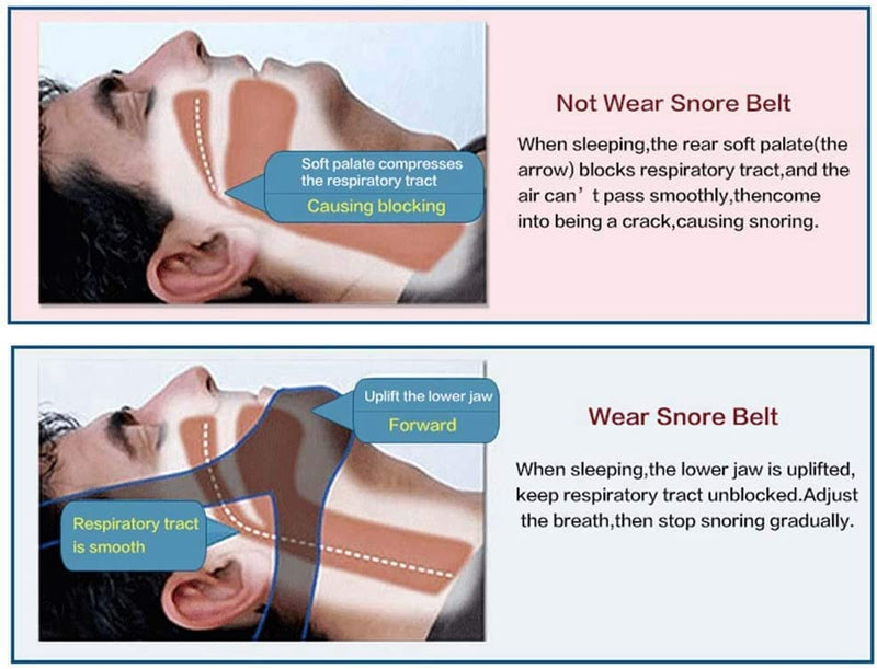 Stop Snoring Chin Strap Anti, Snore Reducing AidsChin StrapsSnore Belt Apnea Jaw Support Solution Sleep - BeesActive Australia