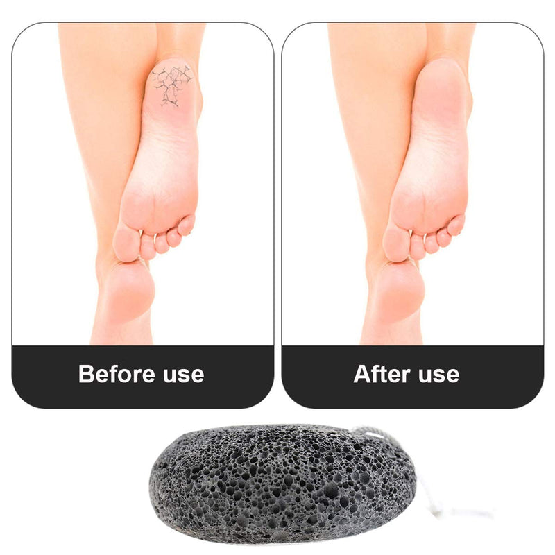 Adofect 2 PCS Lava Pumice Stone for Feet Callus Remove 100% Natural Foot Pumice Stone for Exfoliating Dry Dead Skin, Foot Scrubber Stone for Men/Women, Brown or black at random - BeesActive Australia