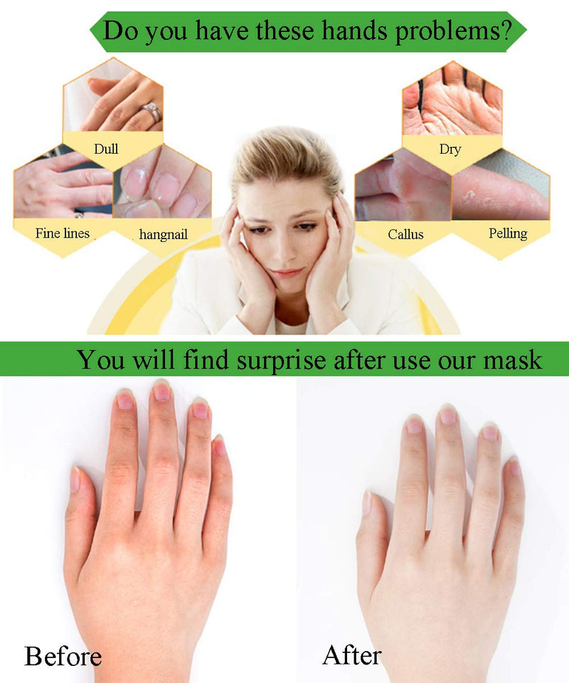 Moisturizing Gloves Hand Mask 5 Pack with Collagen, Shea Butter, Vitamin E - Deep Moisturizing Repair Skin for Dry Rough Hands - Perfect Daily Hand Care Treatment Get Soft Smooth Hands - BeesActive Australia