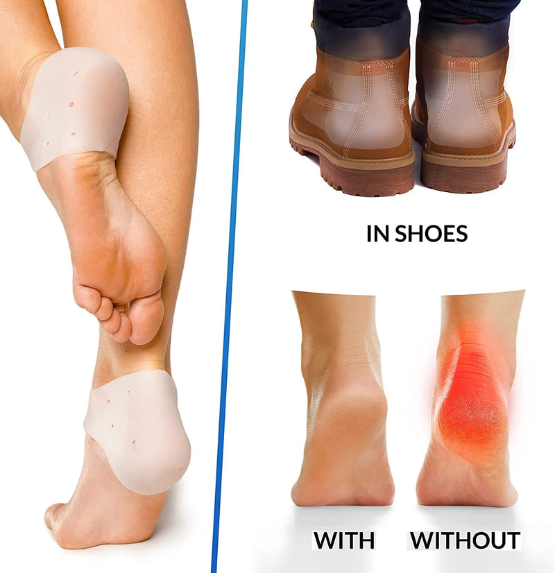 Heel Protectors,6 Pcs Silicone Heel Protectors,Strong and Breathable Heel Protectors, Heel Cups for [Fast Heel Pain Relief],Suitable For Men And Women Dry Cracked Heel Plantar Fasciitis(colourof skin) - BeesActive Australia