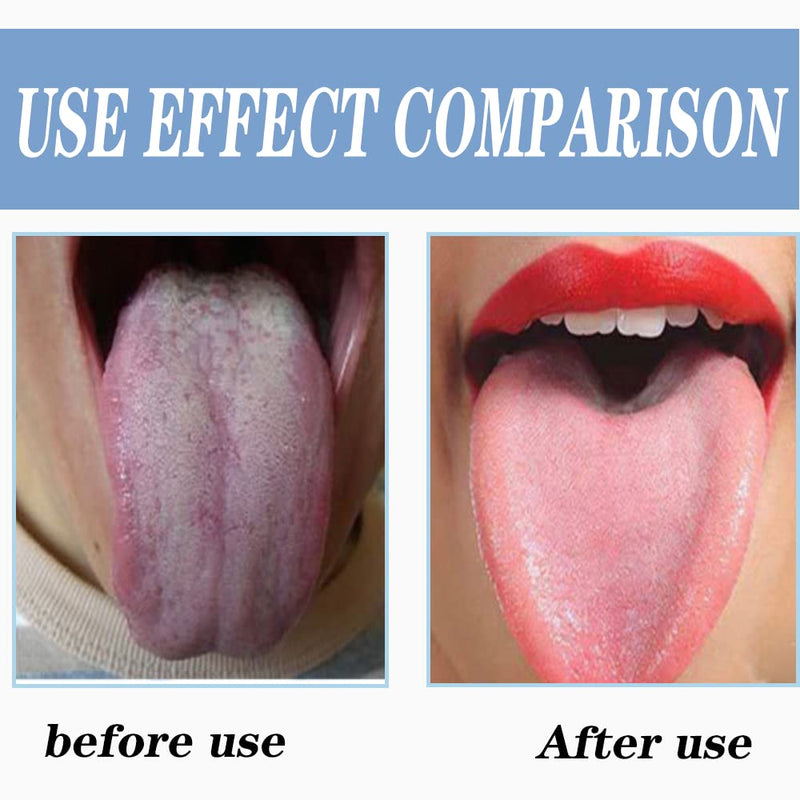 Tongue Scraper Stainless Steel, Tongue Cleaner, Fresh Breath Care Scraper, Great for Oral Care - BeesActive Australia